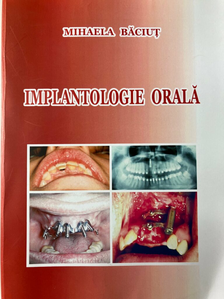 Implantologie Orala von Mihaela Baciut